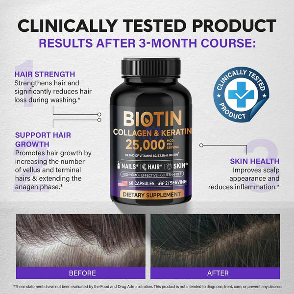 Biotin Collagen & Keratin 25000 mcg Vitamins B2, B3, B6 - Non-GMO Dietary Supplement for Hair Growth Support