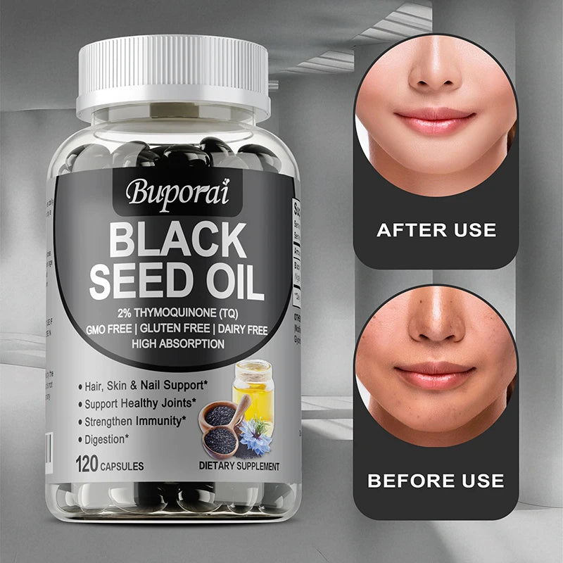 Black Seed Oil Supplement - Digestive Health, Immune Support, for Skin & Hair Health, Antioxidant