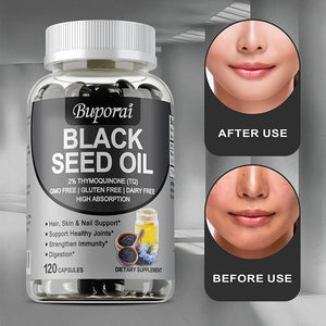 Black Seed Oil Supplement - Digestive Health, Immune Support, for Skin & Hair Health, Antioxidant